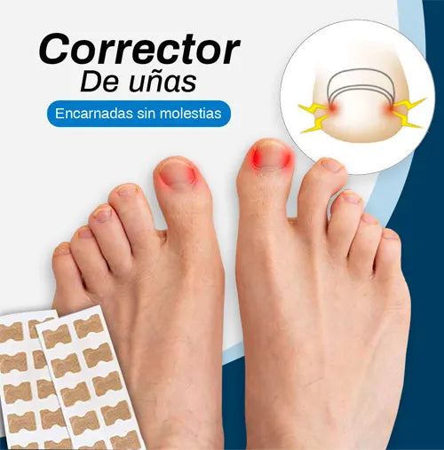 Nails® Parche Restaurador de Uñas x50unds.