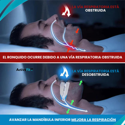 Sleep® Funda Dental Antirronquidos